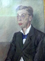 Man with large eyes and extremely weak chin